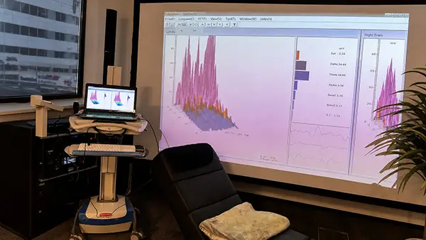 EEG onderzoek tijdens de lessen